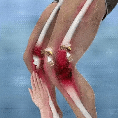 Fectorect Joint & Bone Therapy Cream (Buy 1 Get 1 FREE)