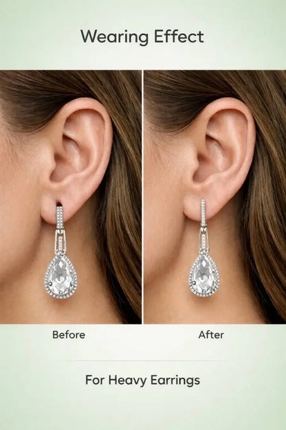 EarLift Pro Comfort Patches | 100 Pcs