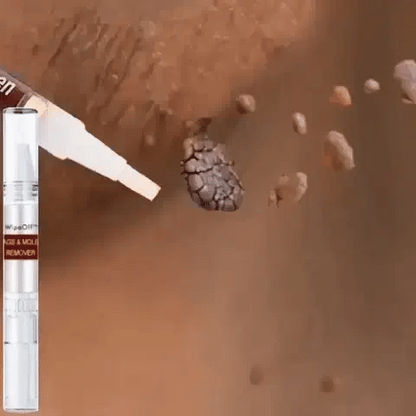 Tags & Moles Remover (Buy 1 Get 1 FREE)