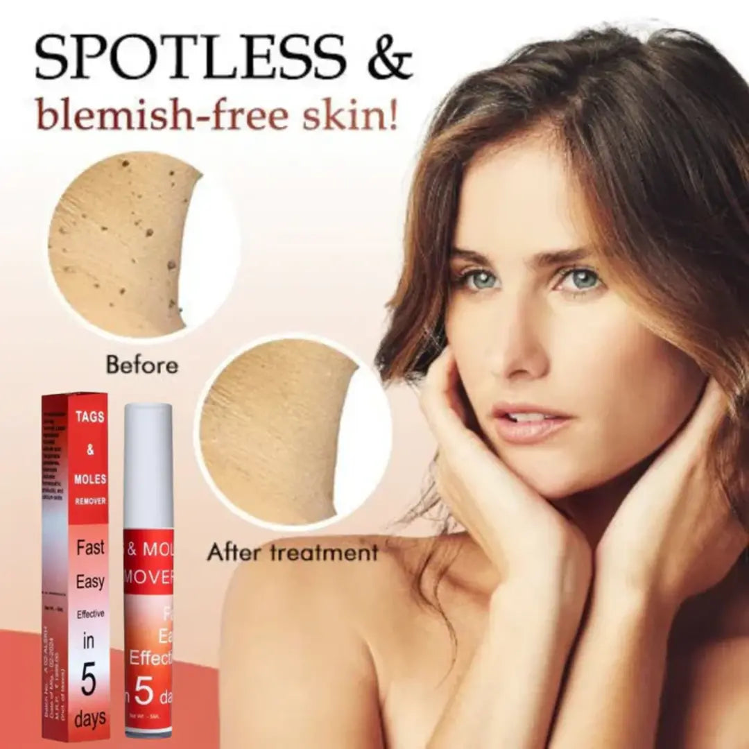 Tags & Moles Remover (Buy 1 Get 1 FREE)